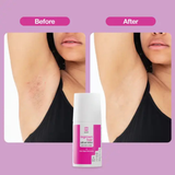 Touch - AHA and BHA Ingrown Hair Roll-on Lotion (2oz)